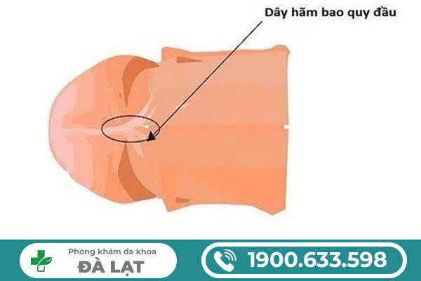 Hình ảnh minh họa